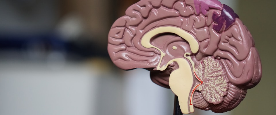 Brain scan images on a lightbox